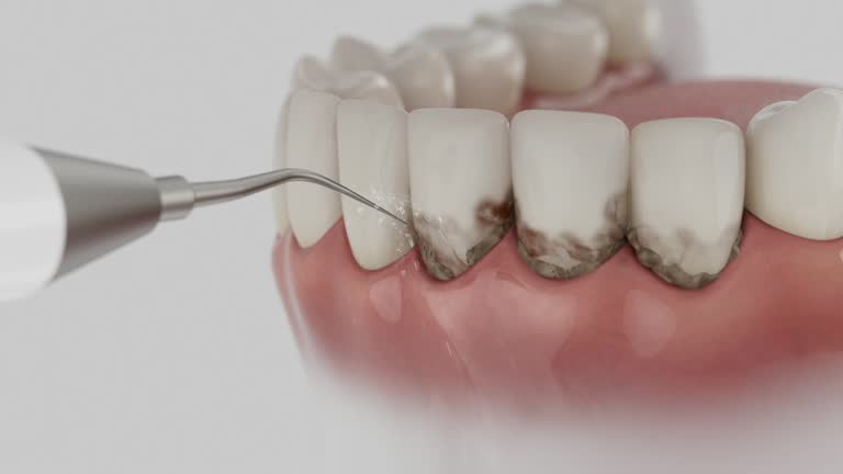 Reliable Emergency Dentist contractor in Dundee, FL by Smile Center Dentistry